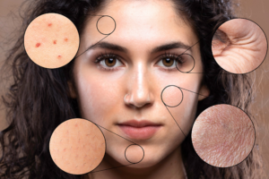 collagen peptides